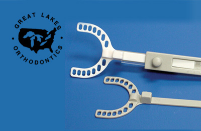 140617 IN GLO Feature