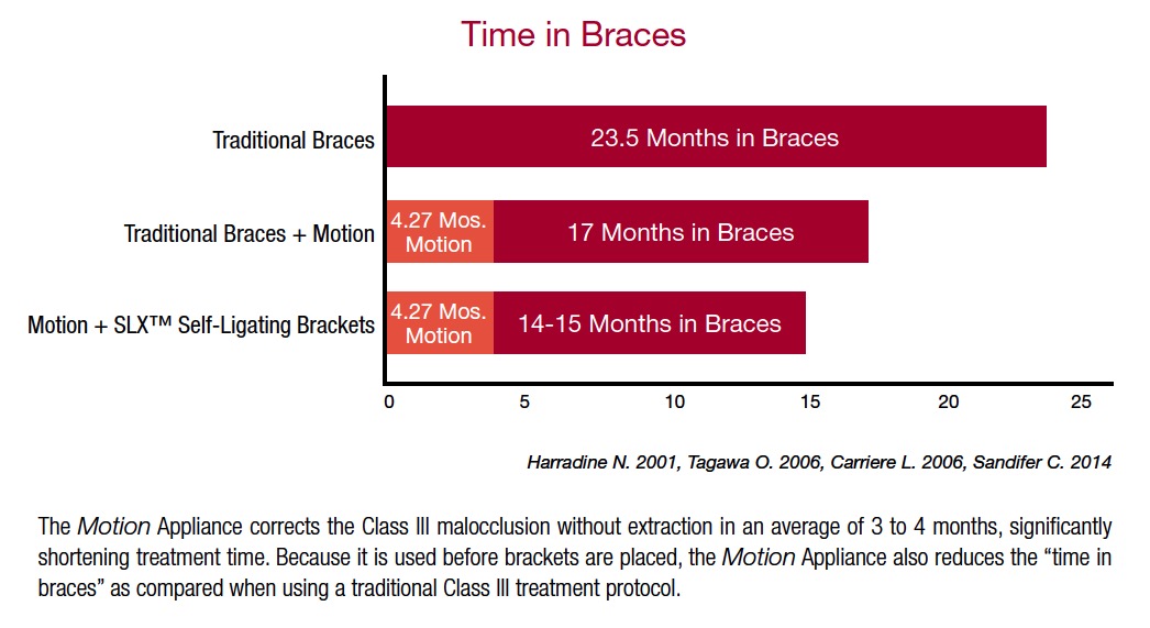 time-in-braces-motion-appliance