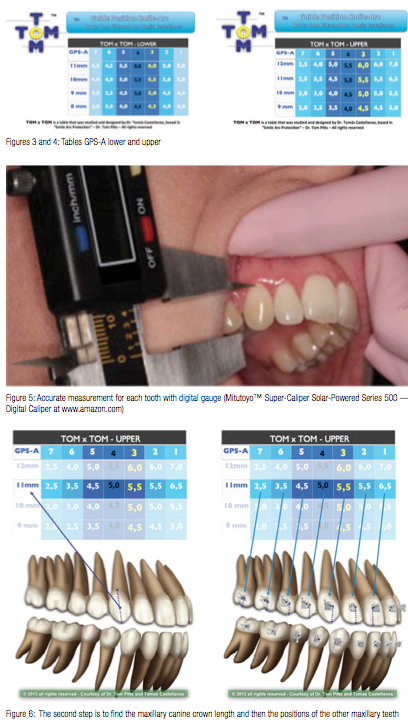 Medentra Orthodontic Star Gauge - Stainless Steel Dental Bracket Positioning Tool | Incisal Occlusal Tooth Gauge