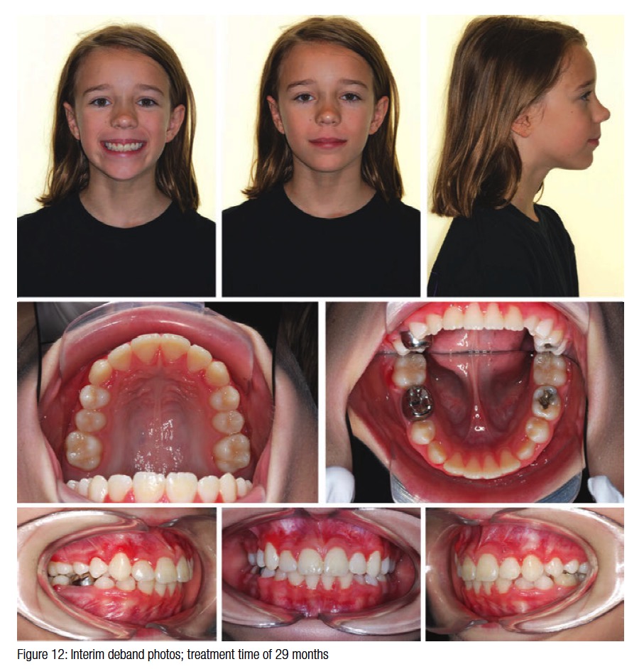 figure12-edgren