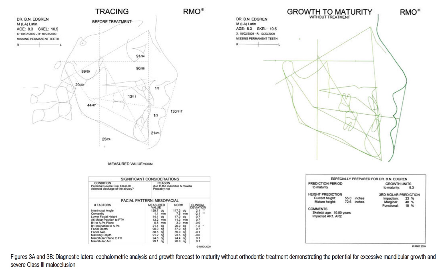 figure3a-3b-edgren