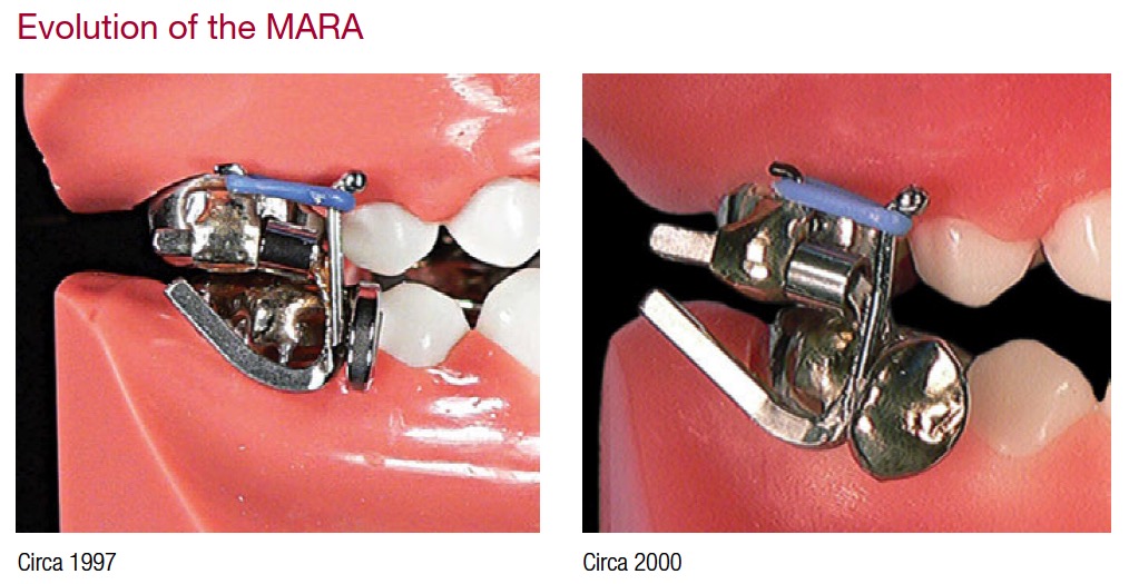 mara-circa-1997-circa-200