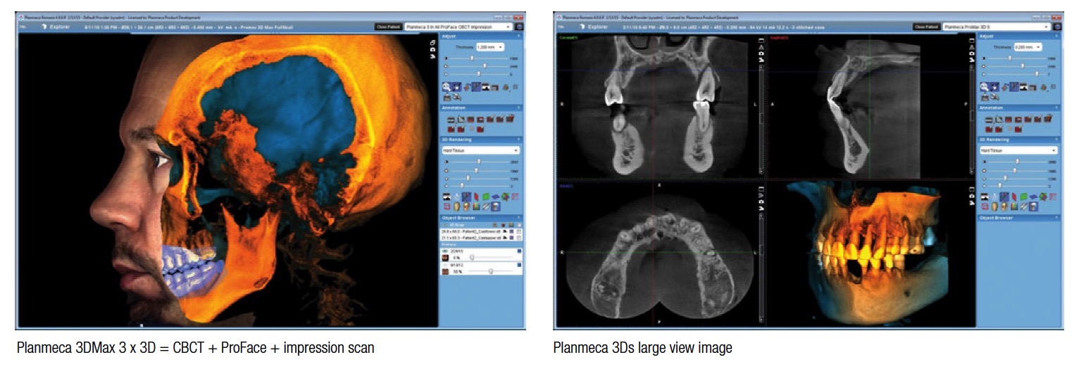 planmeca-3dmax-cbct