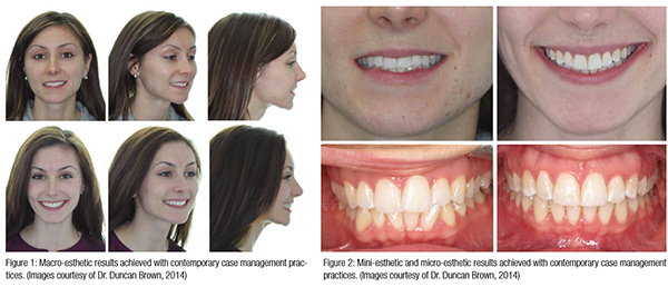 Nov2015_Brown_Fig1-2