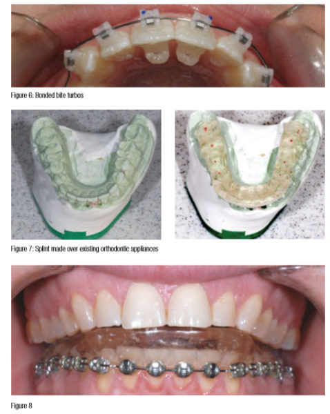 Nov2015_CE-Menchel_Fig6-8