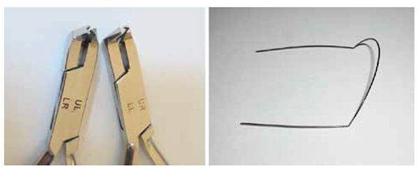 Figures 1A-1B: 1A. A set of Bendistal Pliers used in placing the intrusive V-bends intraorally and extraorally, showing printed abbreviations of the mouth quadrants each pair serves. 1B. The intrusive sharp and permanent V-bends that can be placed behind canine areas in maxillary and mandibular superelastic archwires