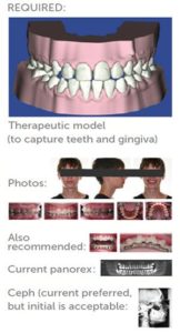 Figure 1: Records needed for suresmile aligners