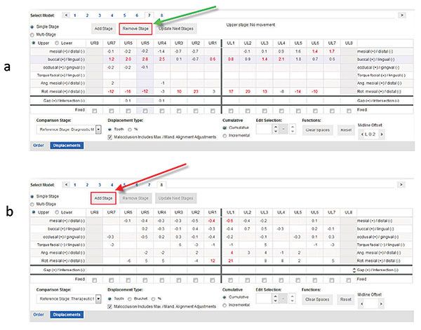Figures 9A-9B: Controlling staging. 9A. Stages of tooth movement can be actively deleted (green arrow) 9B. Or added (red arrow)