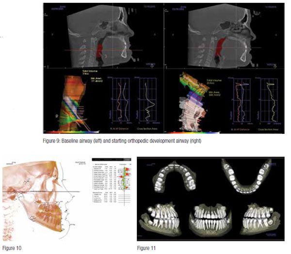 Case_Olmos_fig9-11