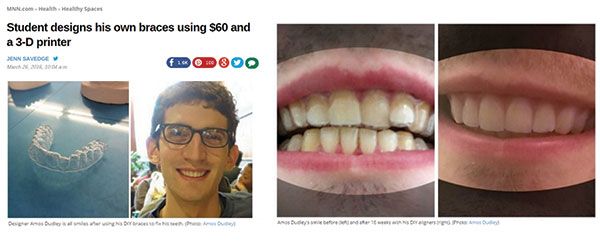 Dentist that do braces that accept caresource blue care vs amerigroup