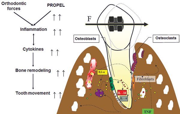 Figure 1: The biology of tooth movement