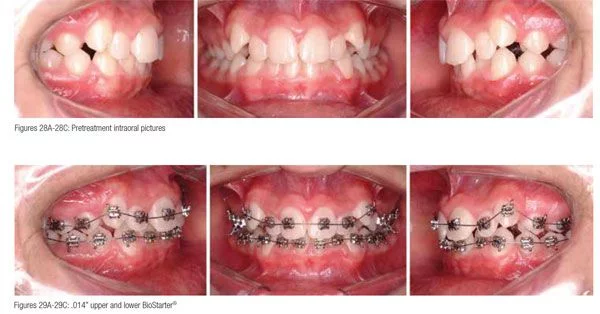 Maintaining clearly defined treatment objectives: part 2