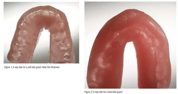 TMJ dysfunction: clicks and trismus – Orthodontic Practice US