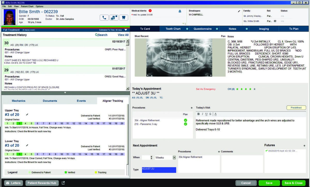 New software enhancements improve workflow in orthodontic offices ...