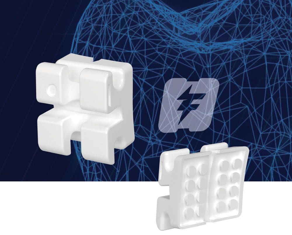 LightForce Orthodontics’ customized bracket system Orthodontic