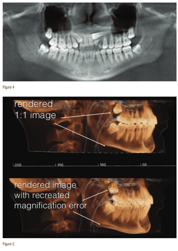 Visualizing anatomy with CBCT improves the orthodontic process