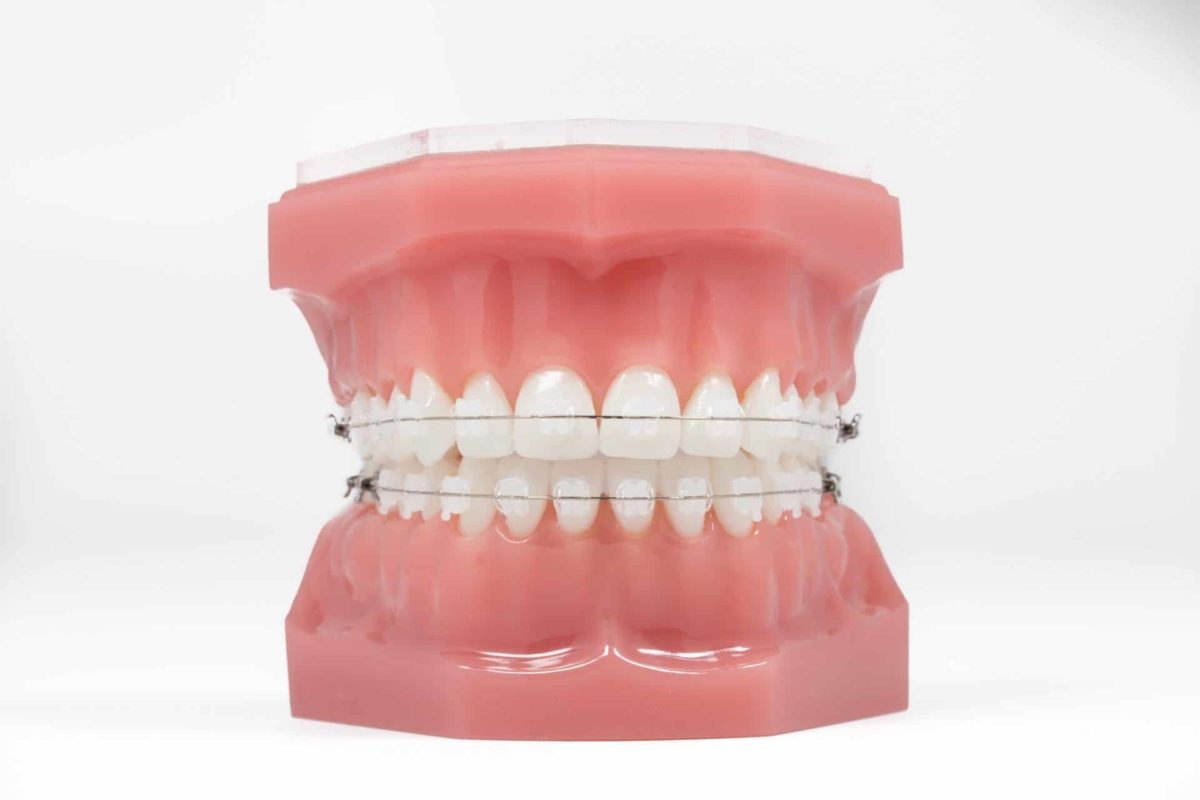 Orthodontic News - ORMCO CORP. OFFERS WEBINAR FOCUSED ON BENEFITS OF ...