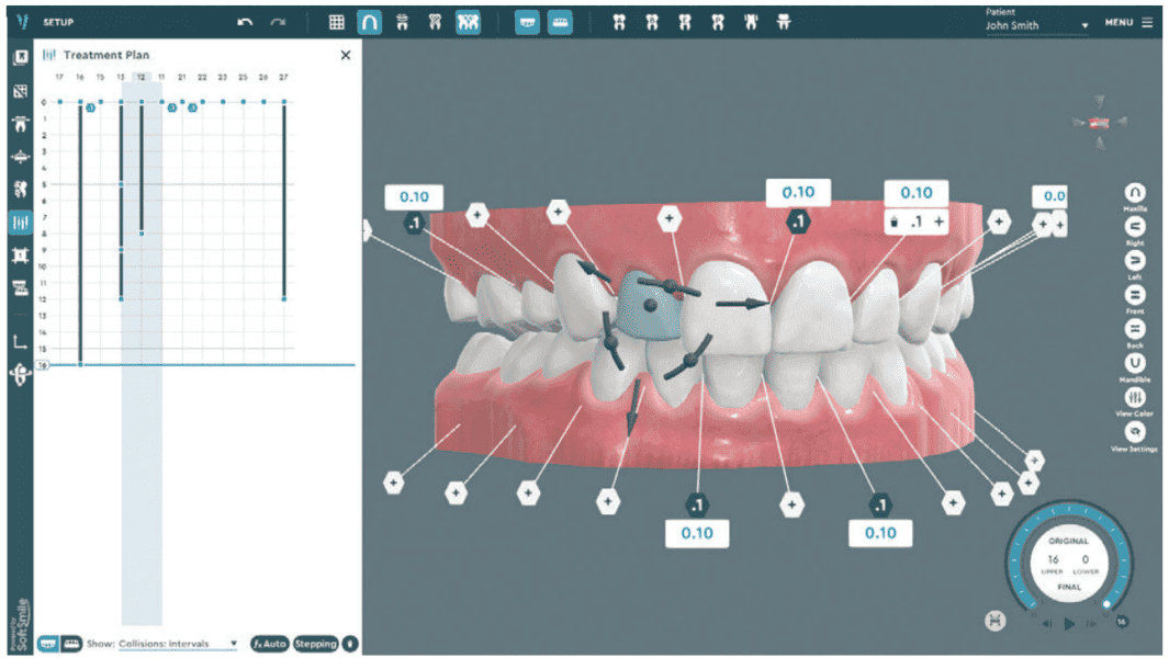 Incorporating Artificial intelligence — for more accurate orthodontic ...