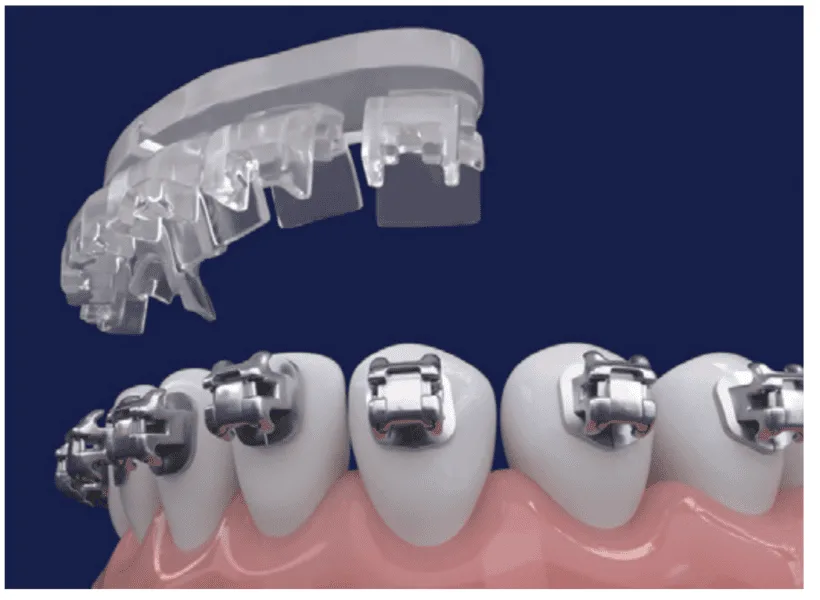 klowen portal KLOwen Orthodontics