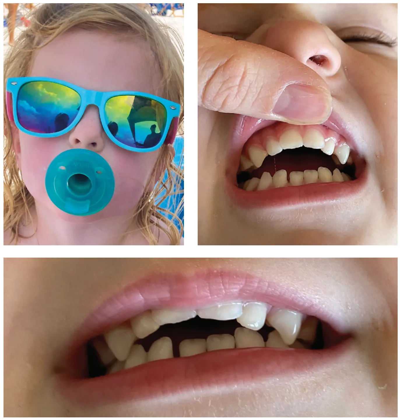 Delaying orthodontic treatment — what are the implications?