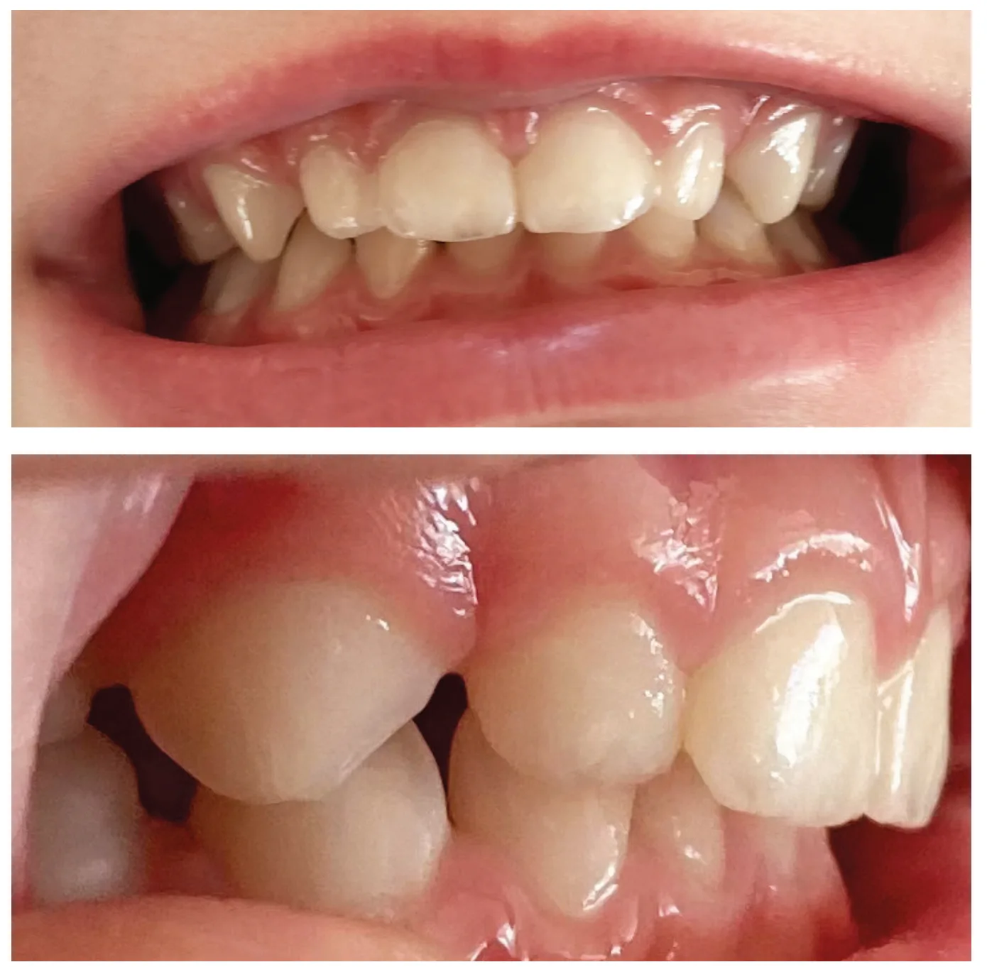 Delaying orthodontic treatment — what are the implications?
