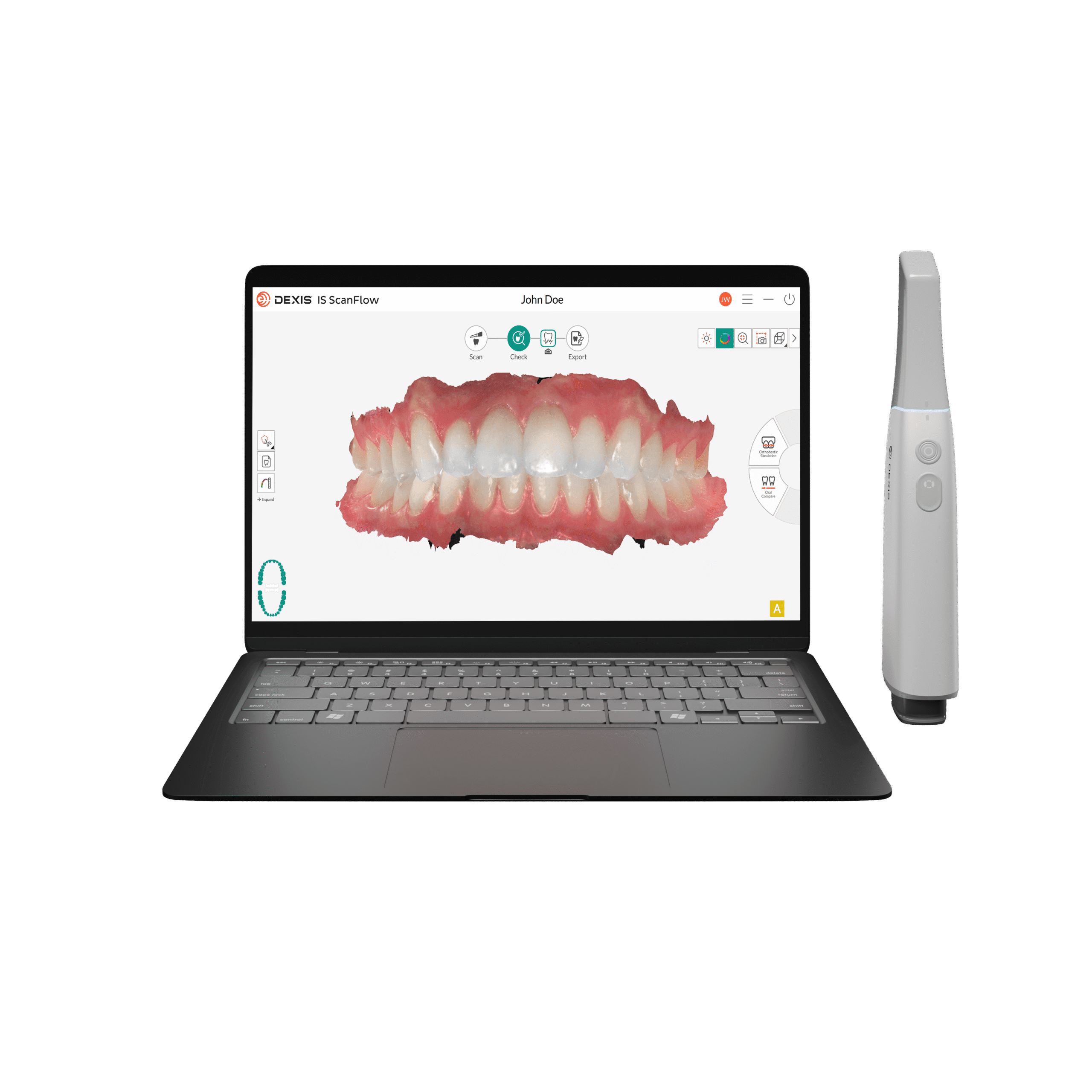 Orthodontic News - DEXIS UNVEILS IMPREVO SCANNER, POWERED BY IS ...