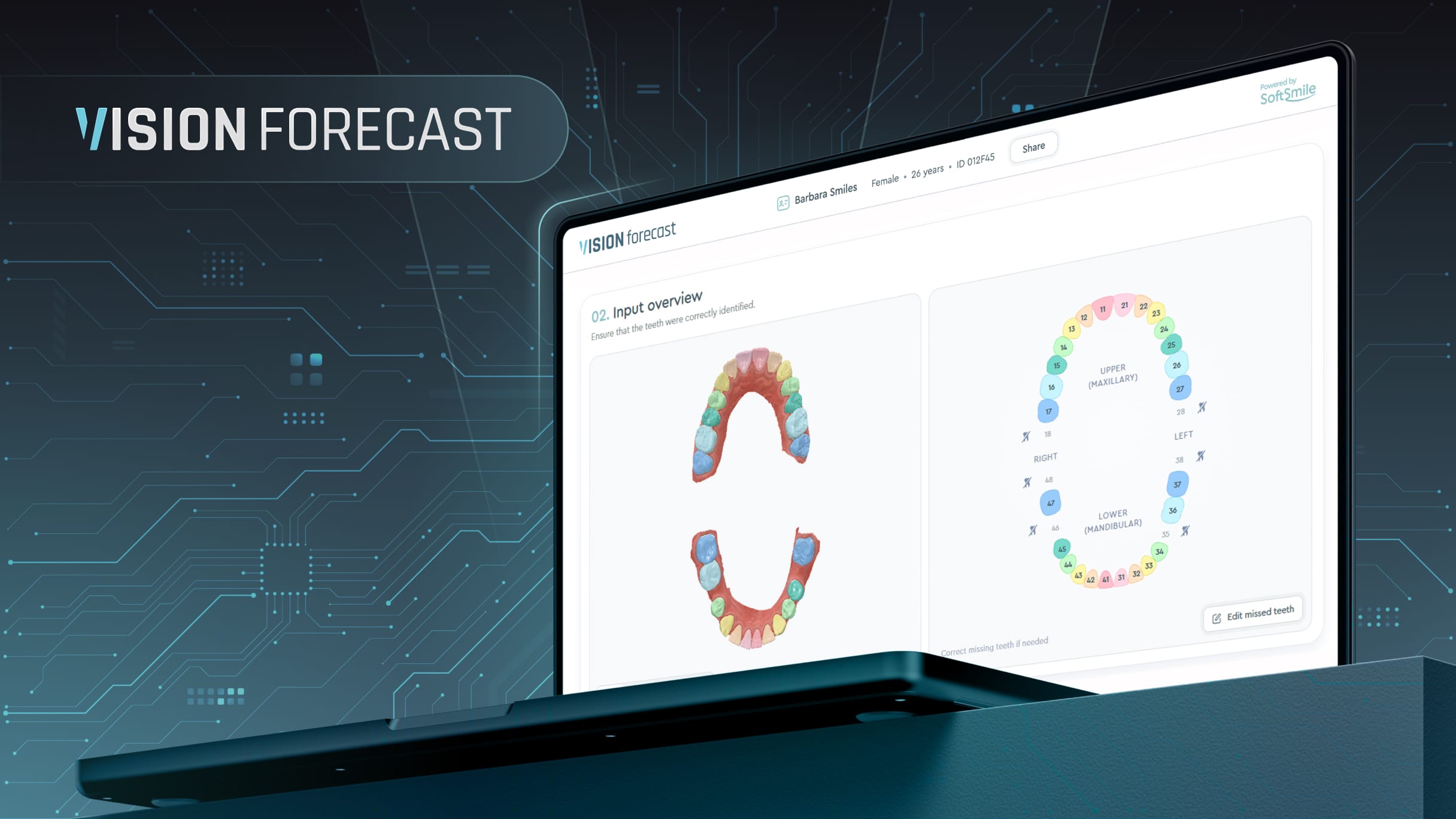 VISION FORECAST SCREEN